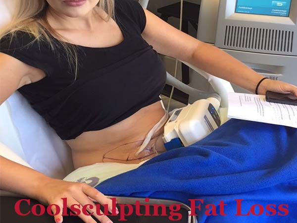 Coolsculpting Weight Loss