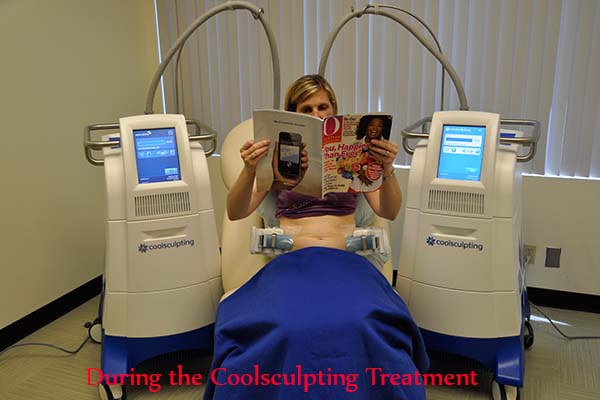 During Coolsculpting Treatments