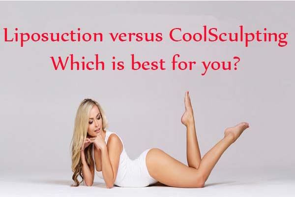 Liposuction versus CoolSculpting for weight loss