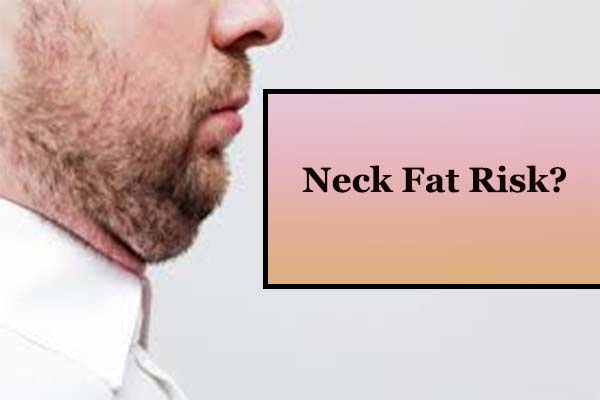 Neck Fat Risks - high cholesterol and diabetes and heart disease