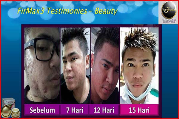 firmax3 testimoni for beauty male