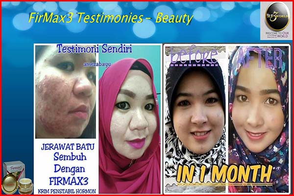 firmax3 testimonial for beauty