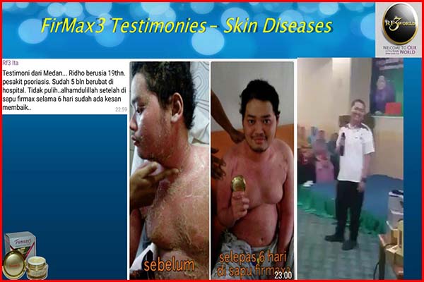 firmax3 testimonial for skin diseases