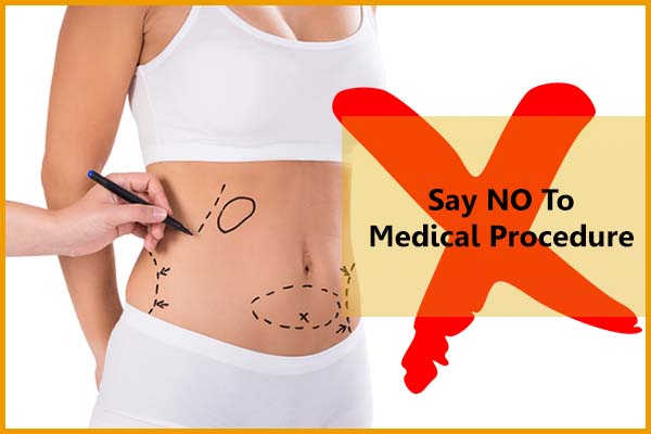 Do not use medical procedure to remove love handles